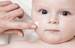 Baby Gesicht bei Neurodermitis mit Creme eincremen