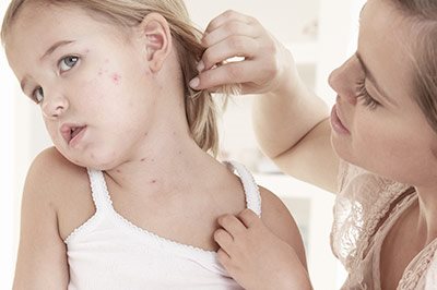 Kind mit Neurodermitis 